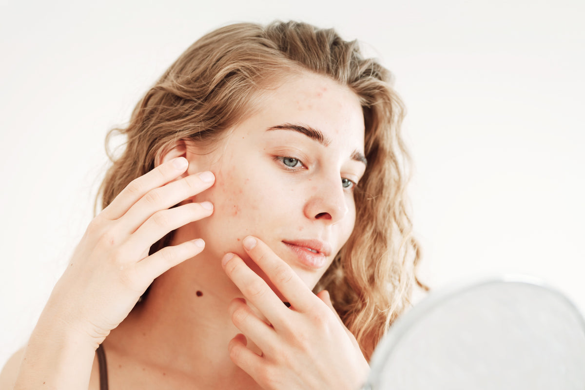Safolyte acne use case