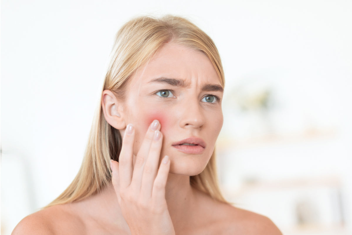 Safolyte eczema and psoriasis use case