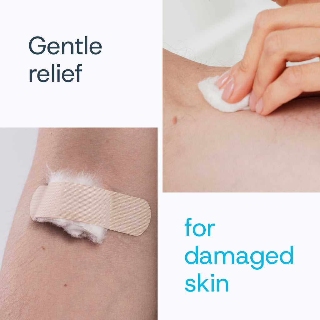 Wound Care Spray