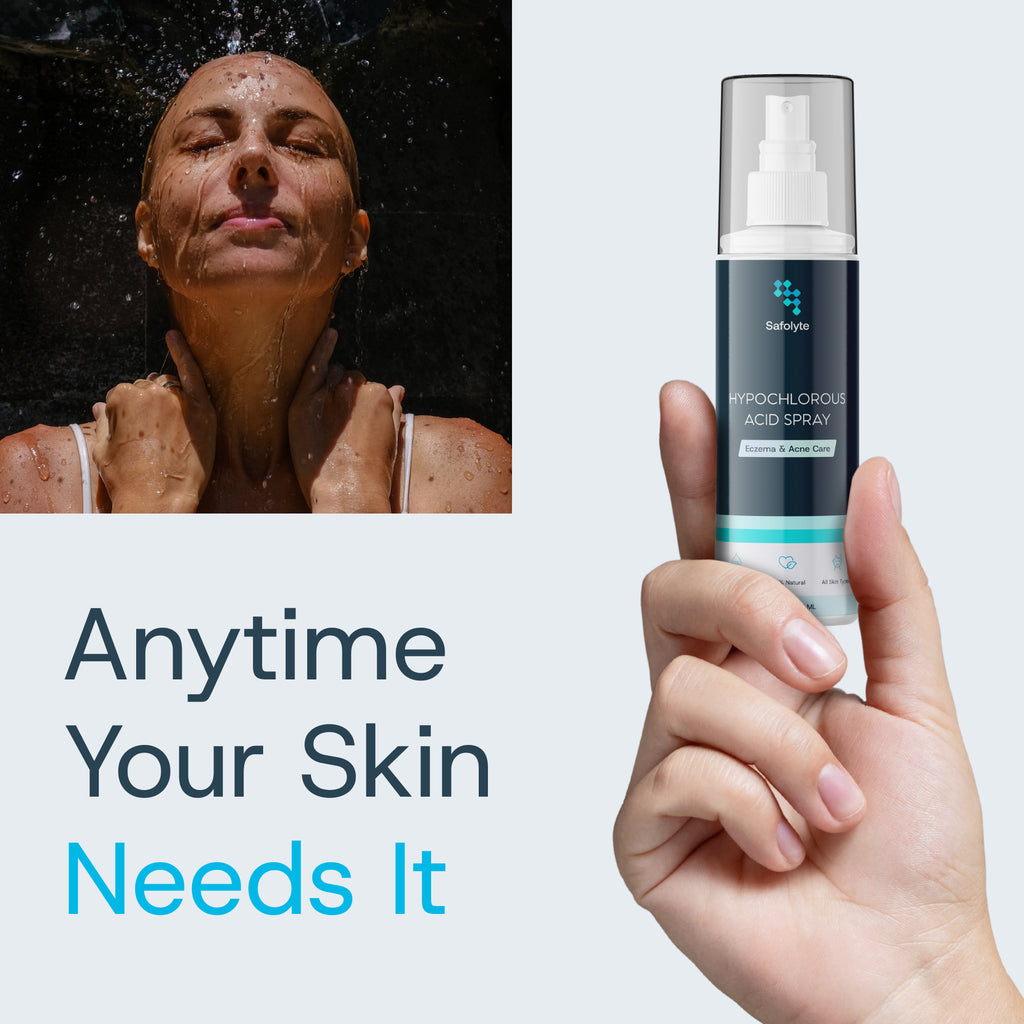 Eczema & Acne Care Spray